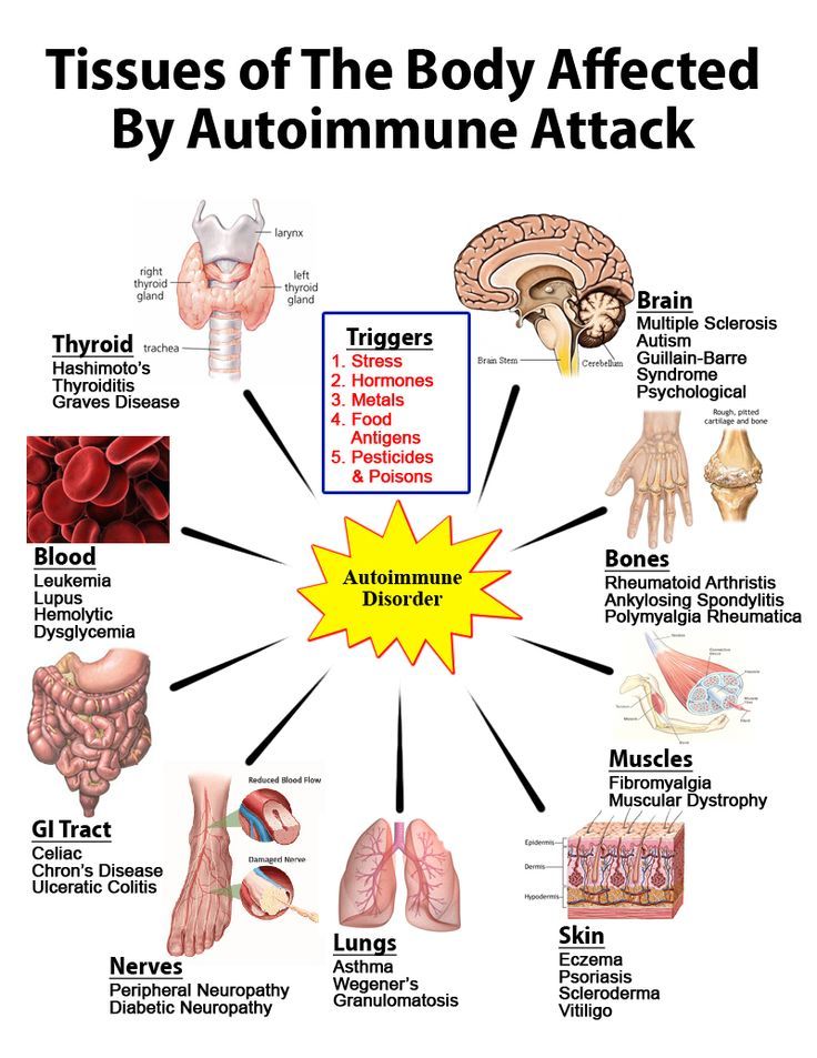 Autoimmune Disease Cure and Treatment in Jalna  Maharashtra
