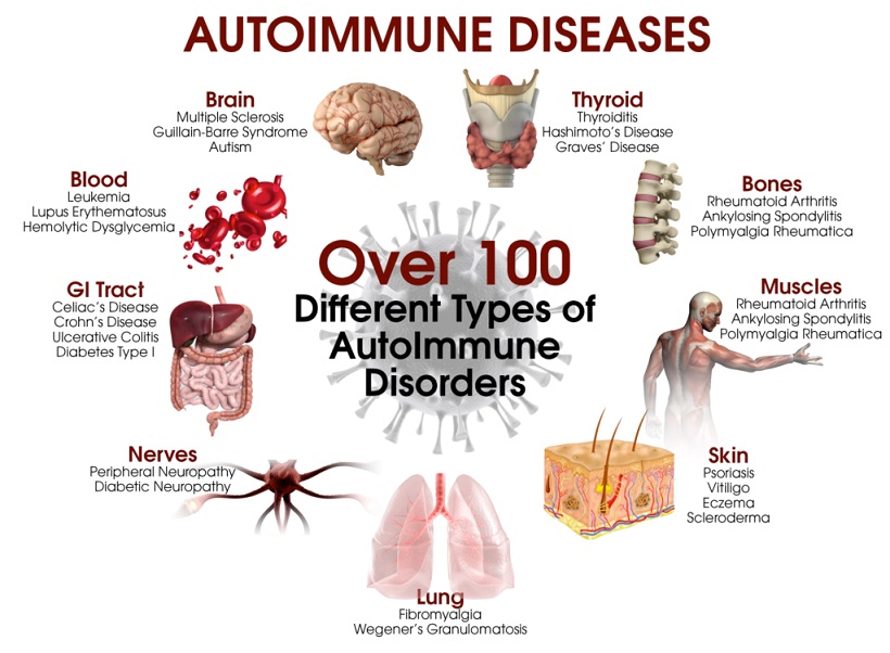 Autoimmune Disease Cure and Treatment in Kishanganj Bihar
