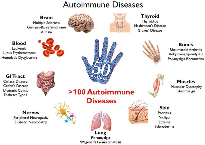 Autoimmune Disease Cure and Treatment in Kurnool  Andhra Pradesh