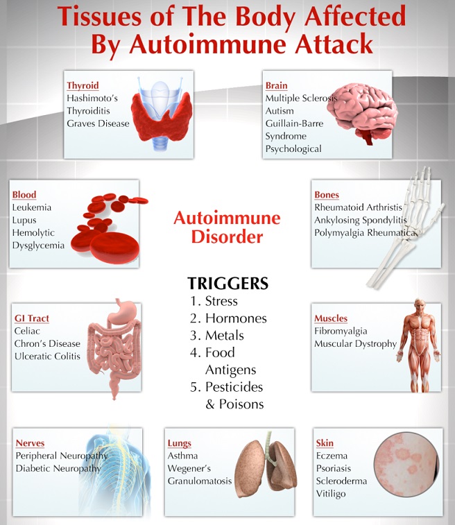 Autoimmune Disease Cure and Treatment in Nanded Waghala Maharashtra
