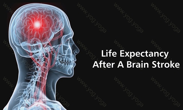 Brain Stroke Cure and Treatment in Rudrapur Uttarakhand