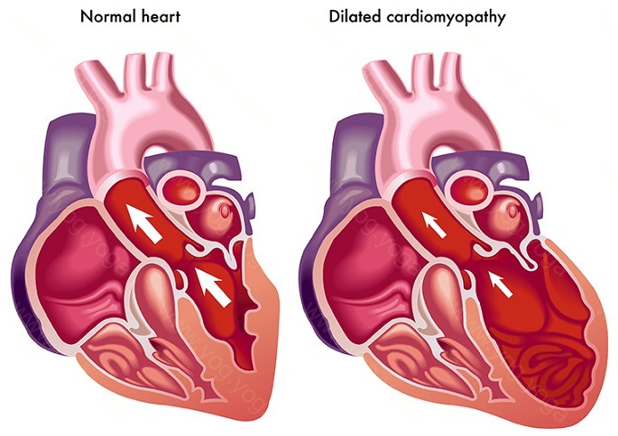 Heart Disease Cure and Treatment in Jalandhar  Punjab