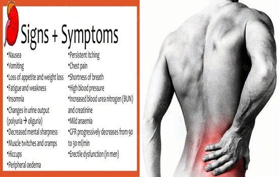 Kidney Disease Cure and Treatment in Bhatpara West Bengal