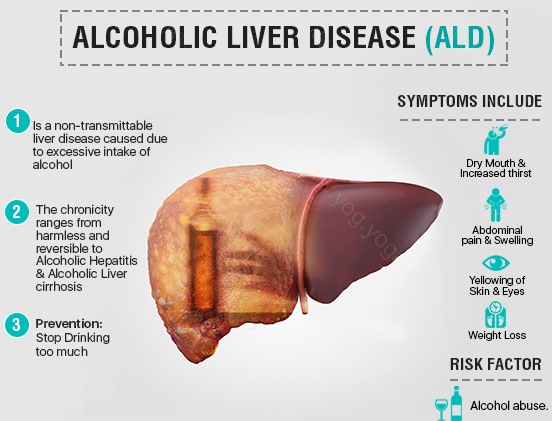Liver Disease Cure and Treatment in Hoshiarpur  Punjab