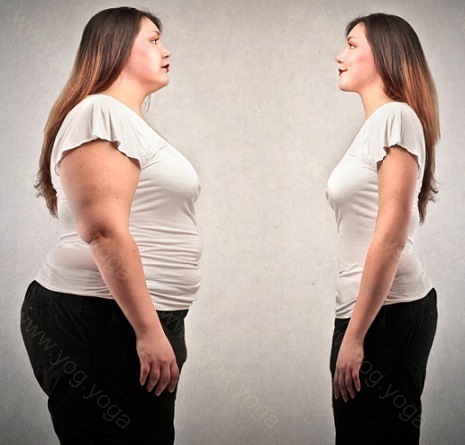 Obesity Cure and Treatment in Sitapur  Uttar Pradesh