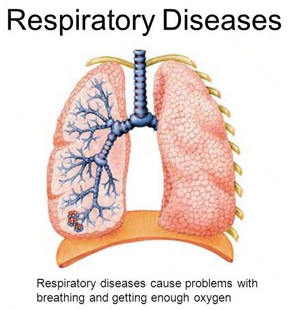 Respiratory Disease Cure and Treatment in Kanpur Uttar Pradesh
