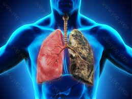 Respiratory Disease Cure and Treatment in Neemuch Madhya Pradesh